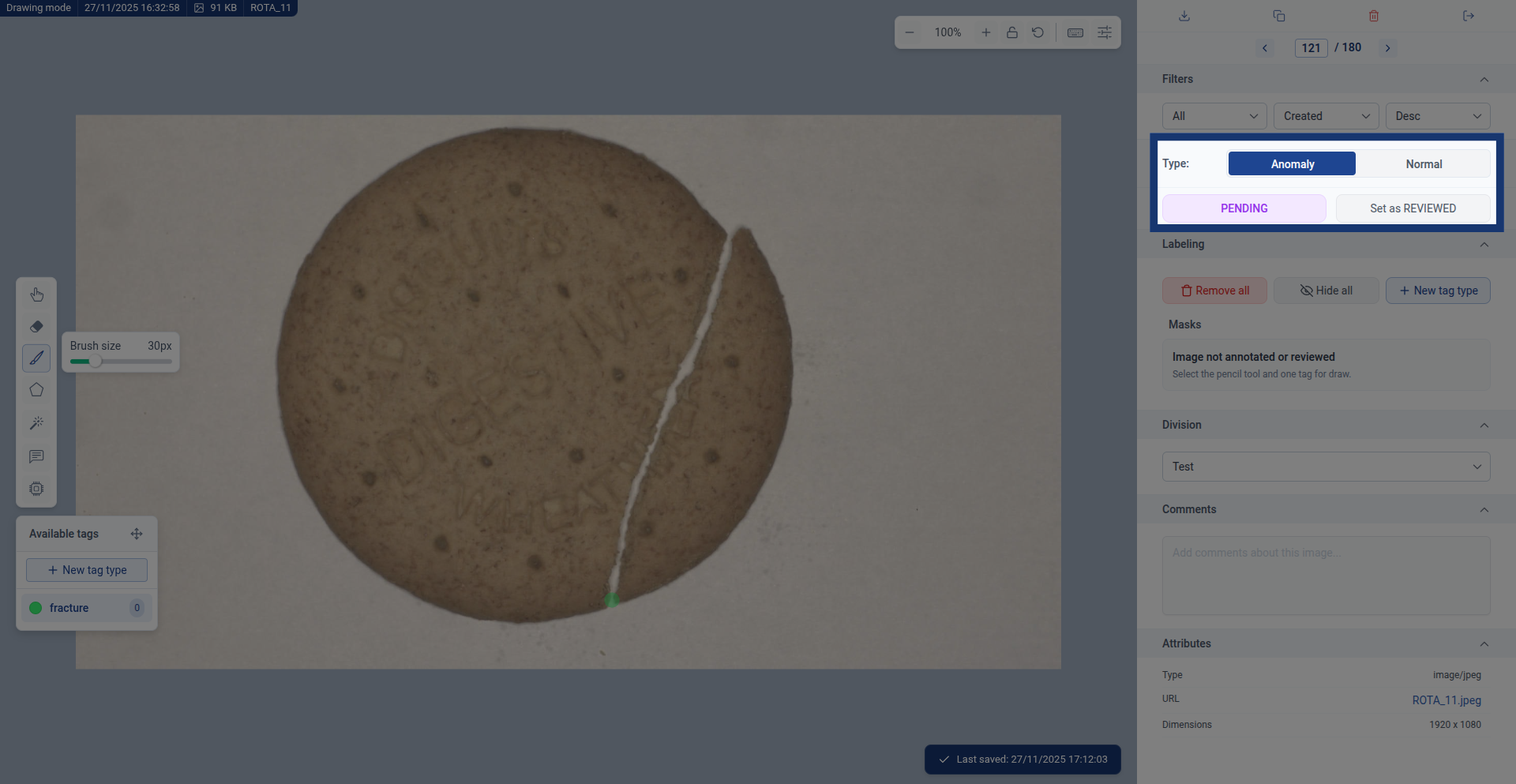 Anomaly vs Normal images