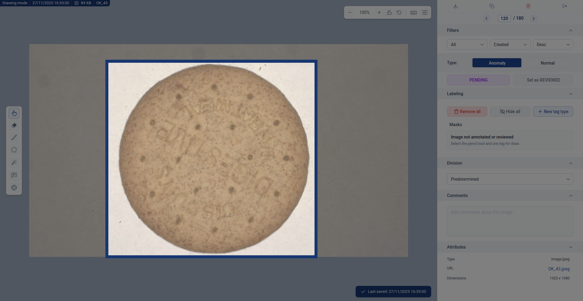 Analyzing a Normal image